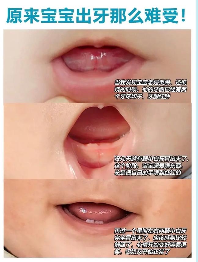 长牙助孕代生宝宝有什么症状